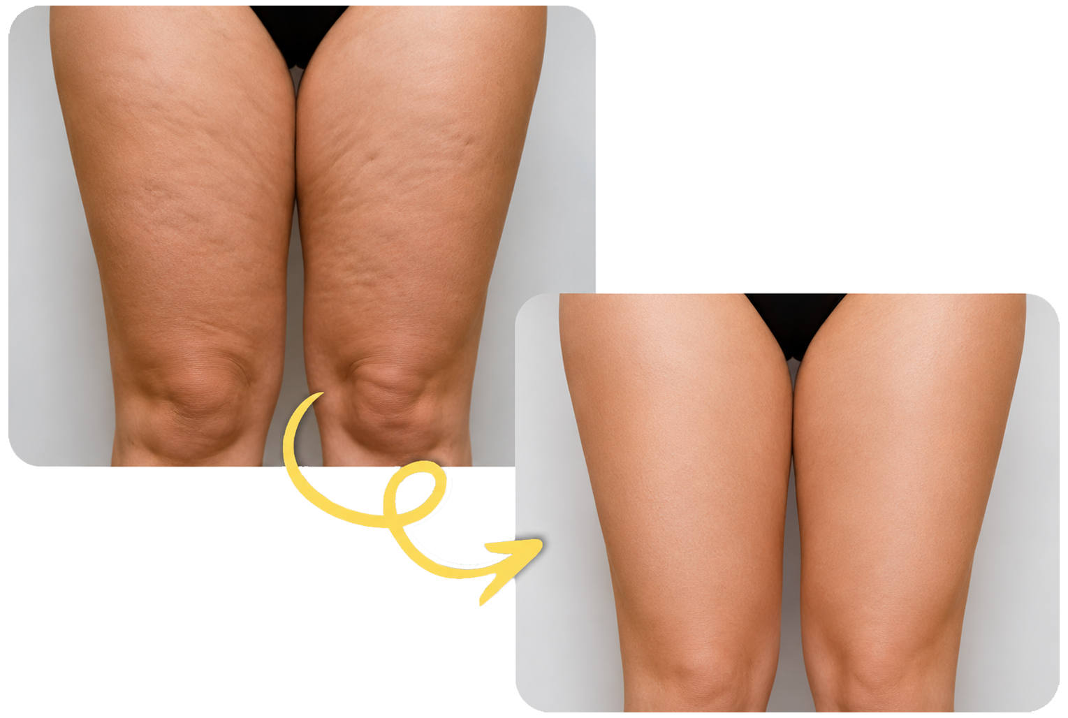 Valutazione corpo personalizzata Estetica 5 Stelle